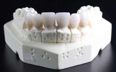 দাঁতের ব্যথা কমানোর উপায় । দাতের মাড়ি ফোলা ও ব্যথা চিকিৎসা । ইনফেকশন সমস্যা ও ঔষধের নাম