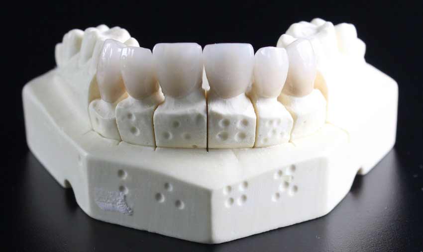 দাঁতের ব্যথা কমানোর উপায় । দাতের মাড়ি ফোলা ও ব্যথা চিকিৎসা । ইনফেকশন সমস্যা ও ঔষধের নাম